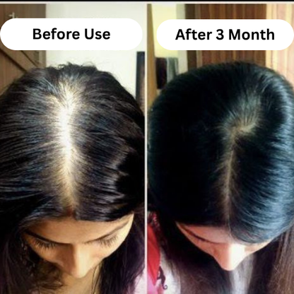 Red Onion Hair Oil