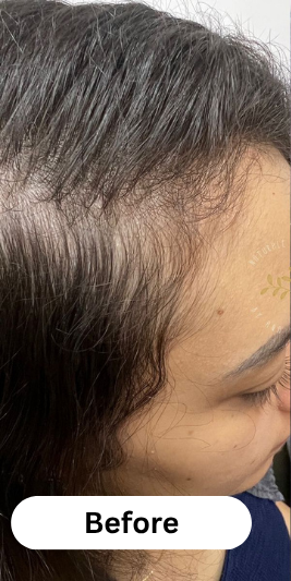 Almond Hair Oil