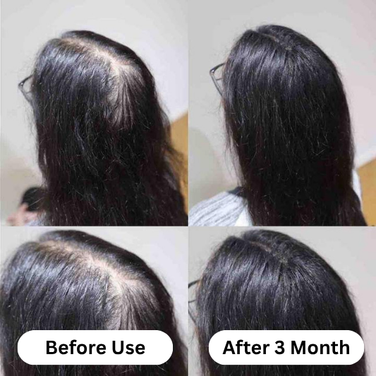 Almond Hair Oil