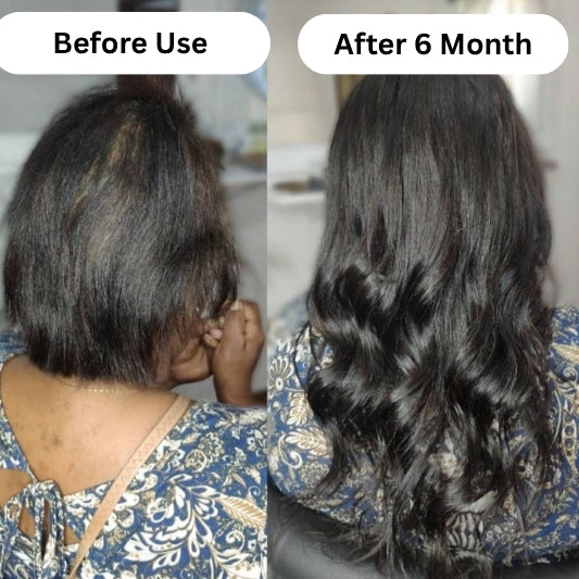 Folitreat Shampoo