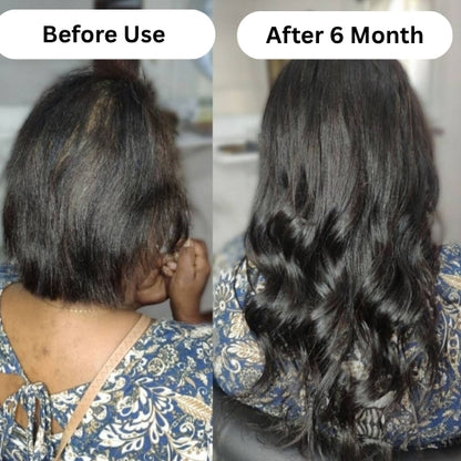 Folitreat Shampoo