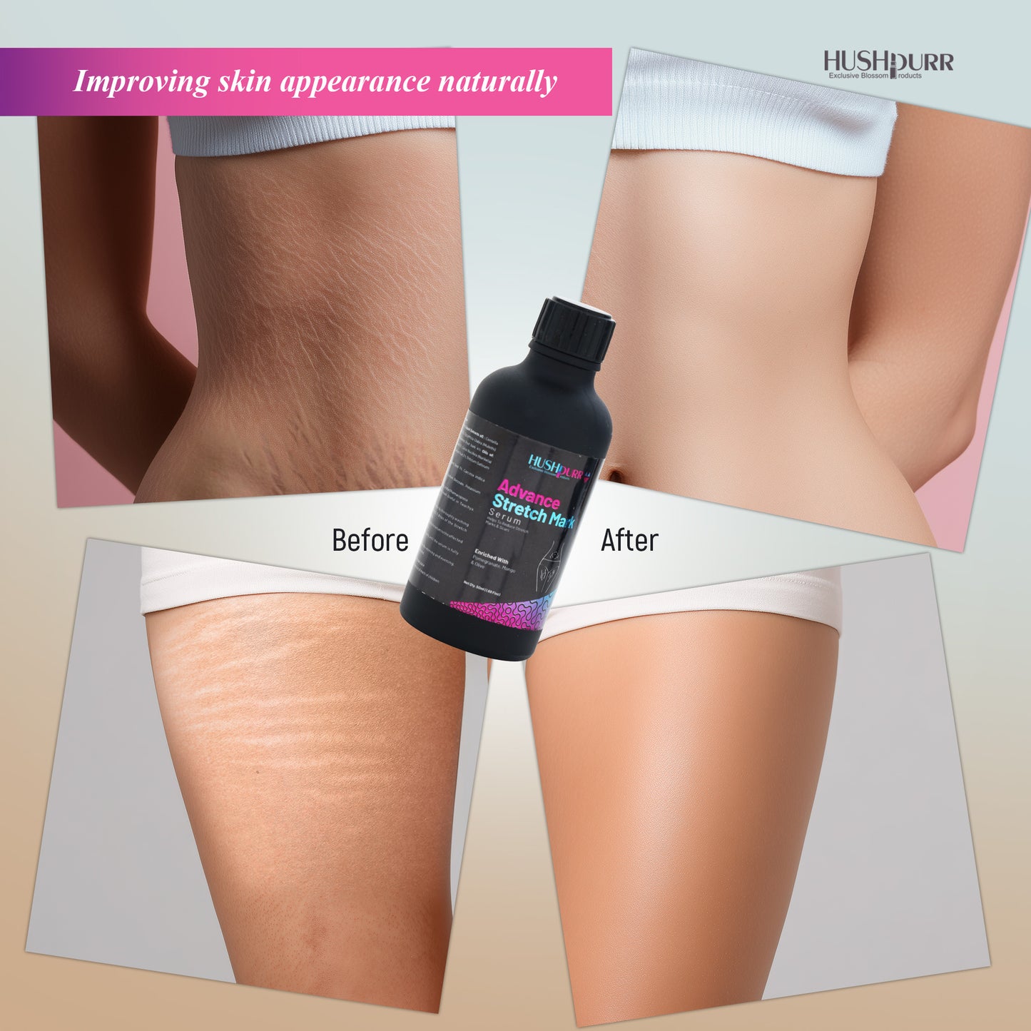 Advance Stretch Mark Serum